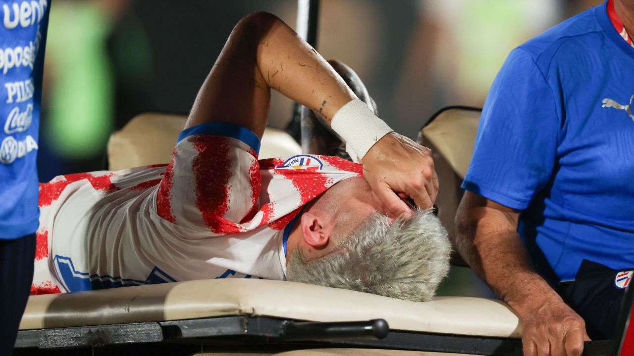 Otra víctima antes del Mundial: Julio Enciso, lesionado