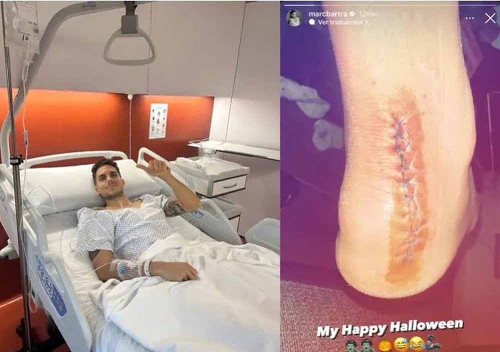 Marc Bartra ha mostrado la cicatriz en su talón tras la operación sufrida.- Instagram Marc Bartra