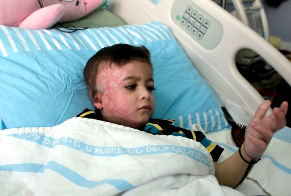 Five-year-old Ahmed Dawabsha, his uncle and his grandparents were to fly from the Jordanian capital Amman to Spain