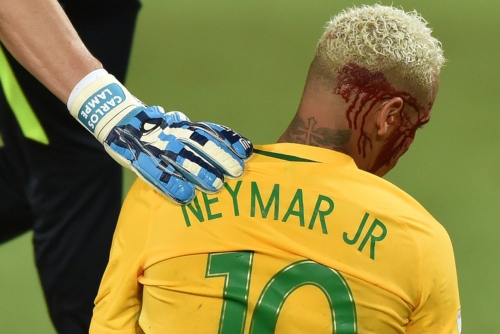 Brazils Neymar bleeds after being injured in the face during the 2018 World Cup football qualifier against Bolivia in Natal, Brazil, on October 6, 2016