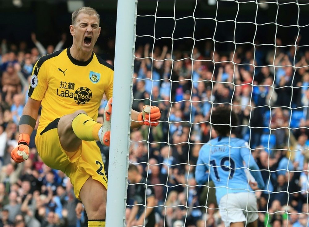 Joe Hart's career has declined rapidly in the last few years. AFP