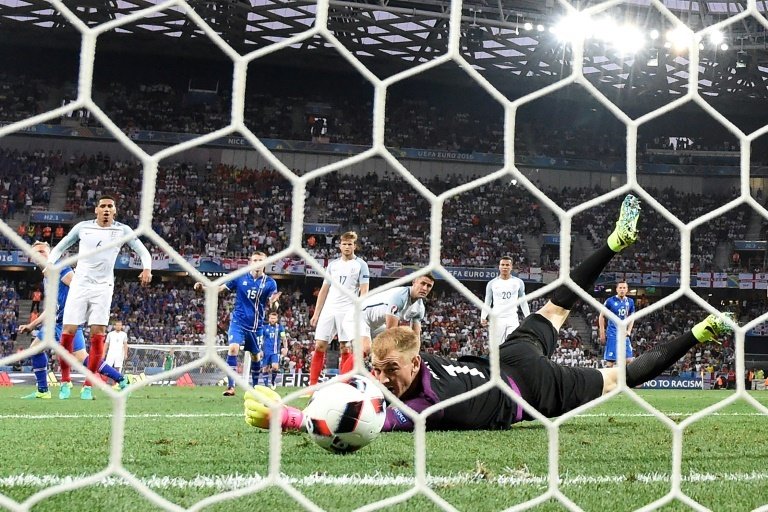 Joe Hart: I'm sorry