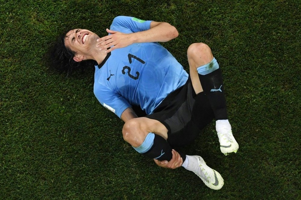 Cavani a mal. AFP