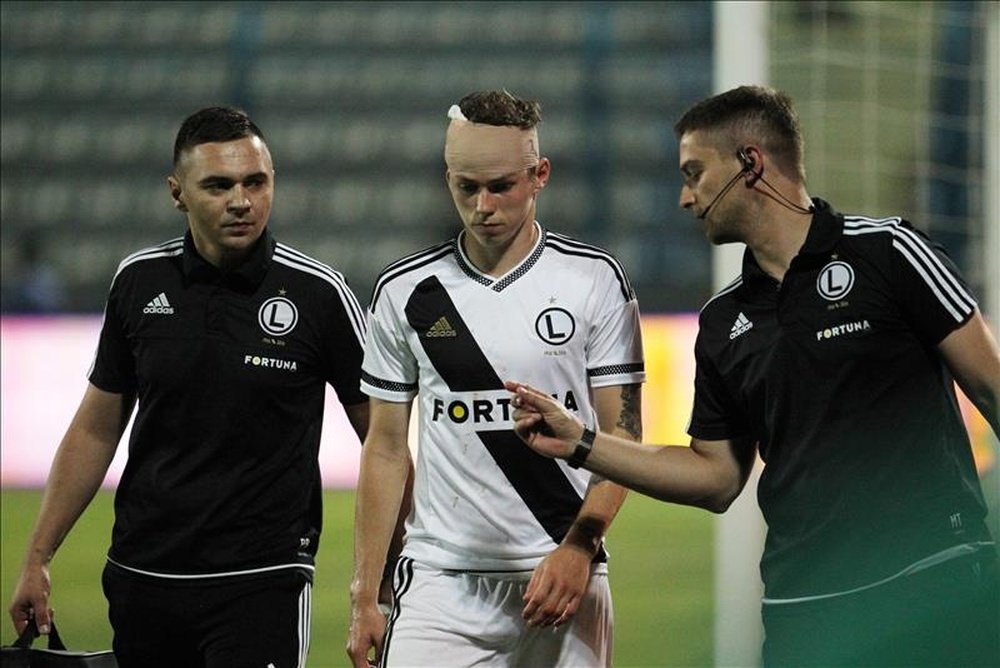 Ondrej Duda (c) del Legia Varsovia abandona el campo de juego por una lesión en el partido ante el FK Kukesi el pasado 30 de julio, durante un partido clasificatorio de la Liga Europa de la UEFA en Tirana (Albania). El juego fue suspendido por disturbios a los 51 minutos. EFE/Archivo