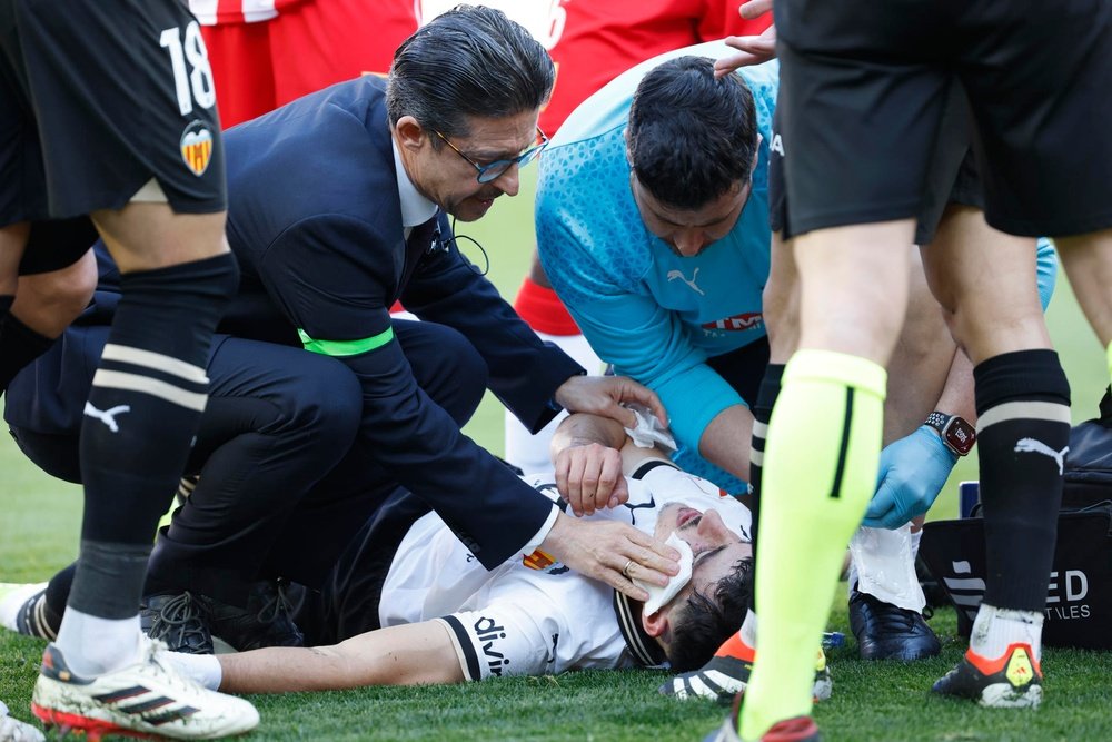 Diego López será operado de una fractura en la cara. EFE
