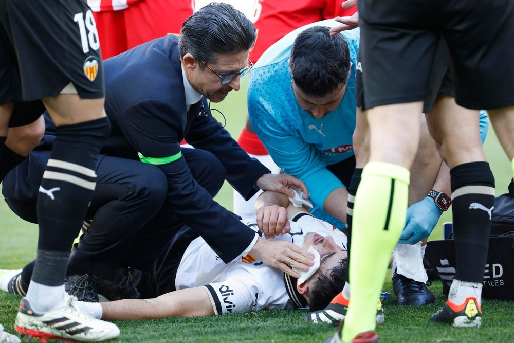 Diego Lopez will have to undergo facial surgery. EFE