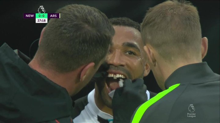 Wilson casi pierde un diente en el Newcastle-Arsenal. Captura/DAZN
