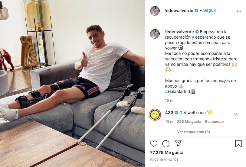 Valverde broke his leg. Screenshot/Instagram/fedeevalverde