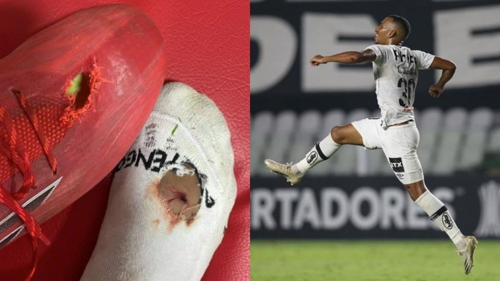Así quedaron la bota y el pie de Braga tras el Libertad-Santos. Instagram/olucasbraga