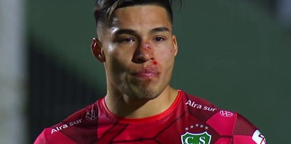 Sebastián Meza sufrió varios cortes en la cara. Captura/TNTSports