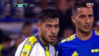 Así le quedó el ojo a Ojeda tras el golpe del 'Pulpo' González. Captura/ESPN