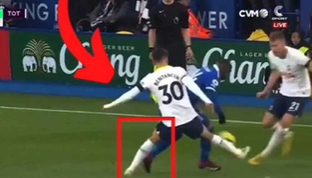 Rodrigo Betancur went off injured against Leicester. Screenshot/CVM