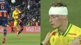 Montpellier y Nantes empataron a uno en un partido que dejó una de las imágenes de la jornada: la peligrosísima patada casi a la altura del cuello de Arnaud Nordin, que fue expulsado.