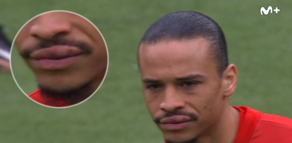 Sane came out with his lip swollen after supposed punch. Screenshot/MovistarFutbol