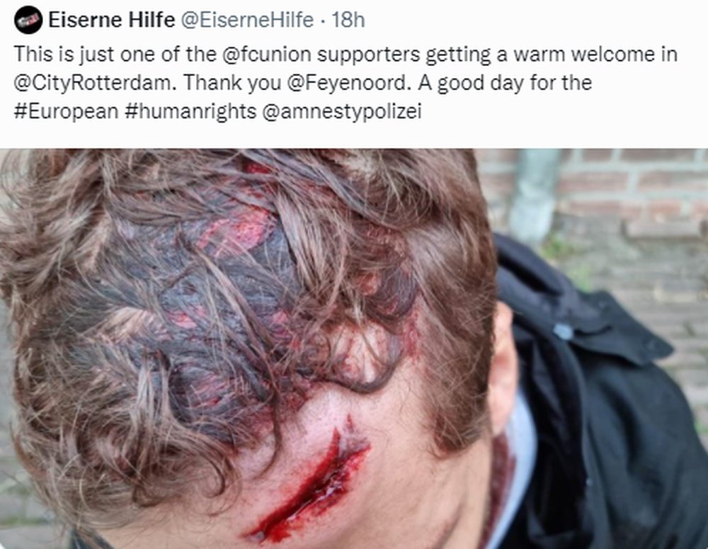 Hubo aficionados heridos. Captura/Twitter/EiserneHilfe