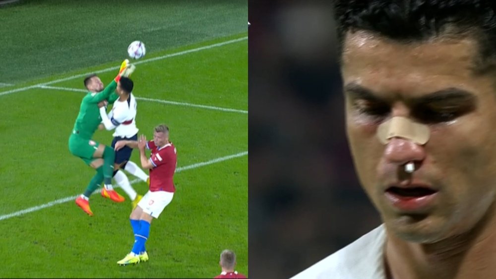 Así le dejó la cara Vaclik a Cristiano. Capturas/UEFATV