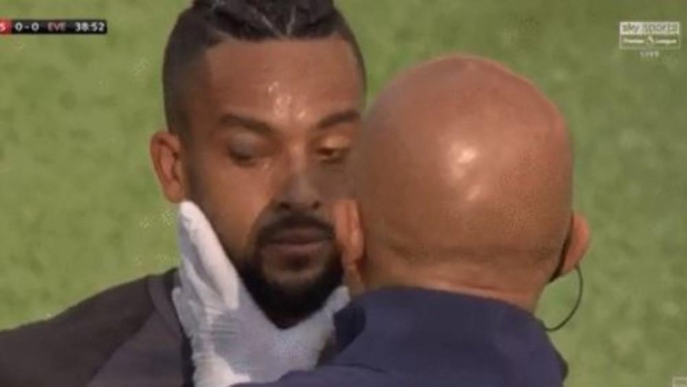 Walcott se llevó un pelotazo ante el Arsenal. Captura/SkySports