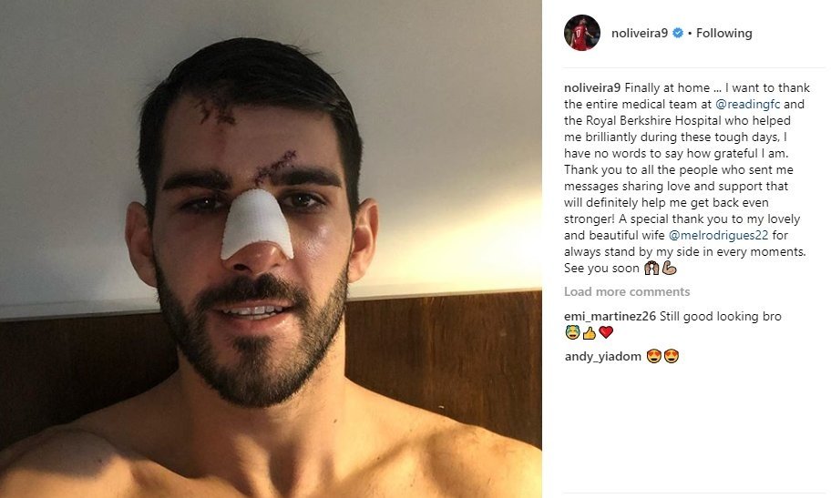 Oliveira, operado con éxito del rostro
