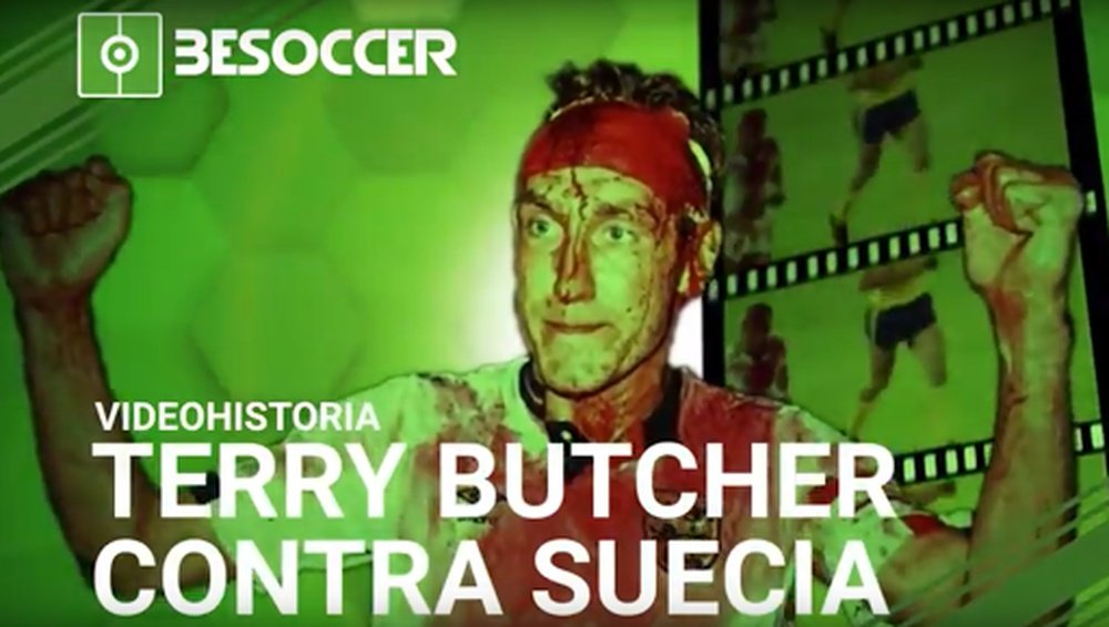 Terry Butcher jugó un partido casi completo con una herida en la cabeza. BeSoccer