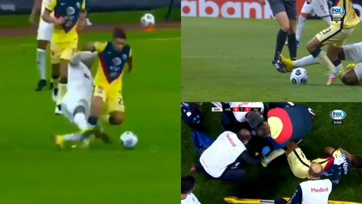 La aparatosa lesión del Chucho López en la 'Concachampions'