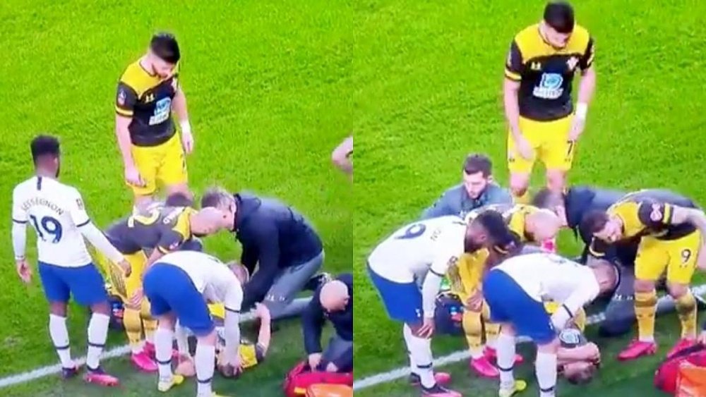 Horror injury for Ward-Prowse. Captura