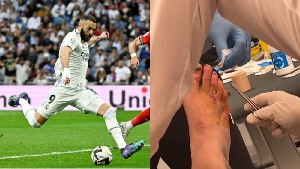 Benzema need 5 stitches after the game. AFP/KDjaziri