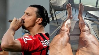 Las piernas de Zlatan Ibrahimovic, tras la operación. Imagen / Instagram