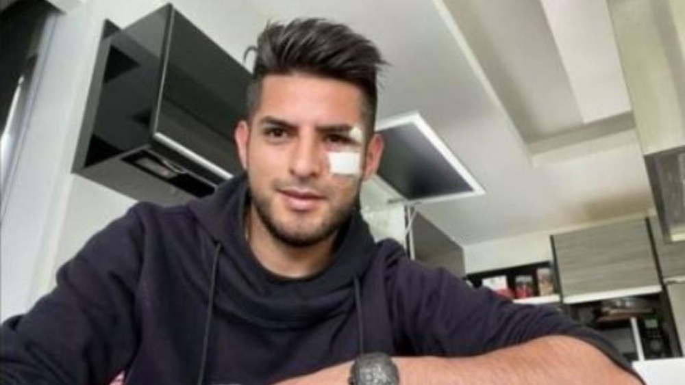 Carlos Zambrano recibió 15 puntos de sutura en el rostro. Instagram/carloszambrano5