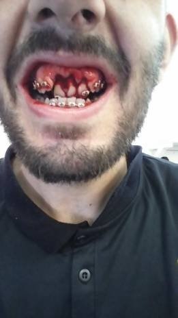 Así le dejaron la boca a un jugador del Jaén en Melilla