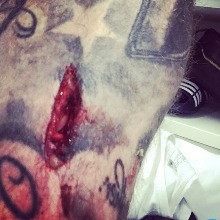 Escalofriante herida de McClean tras el partido ante el Liverpool