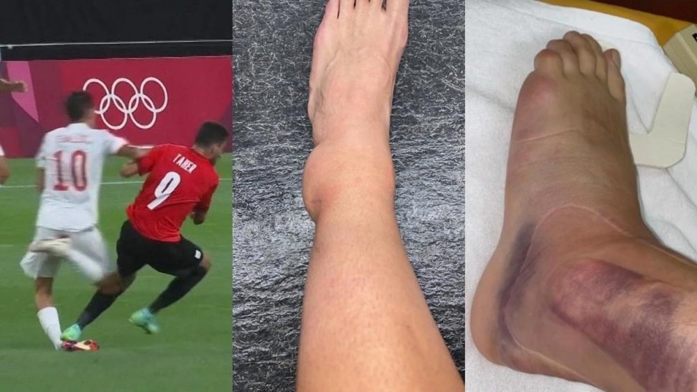 Ceballos sufrió un esguince de tobillo. Capturas/TVE-Instagram/danifuli10