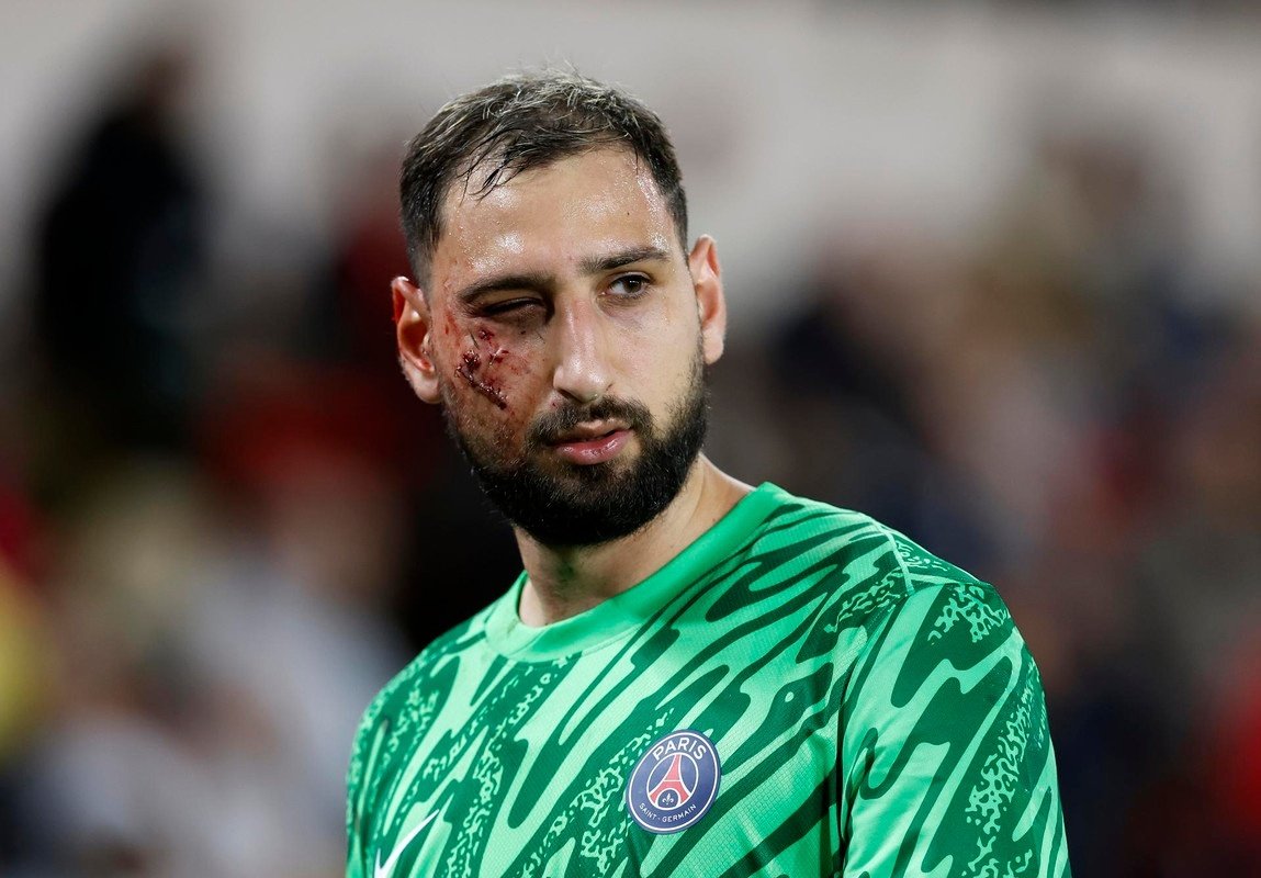 Gianluigi Donnarumma awaiting further tests. EFE