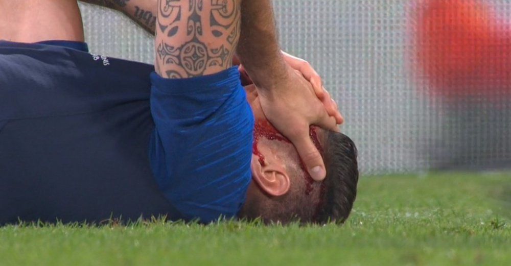 Giroud suffered a nasty head injury against the United States. Captura