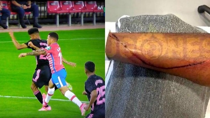 And it wasn't even a yellow: Marvin's leg after Machis challenge
