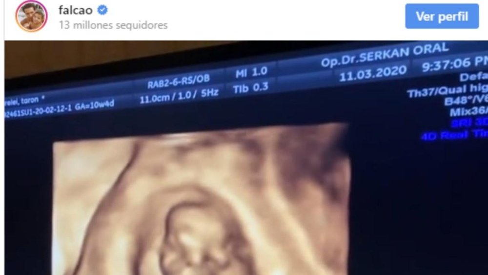 Falcao annonce qu'il va être père pour la quatrième fois. Instagram/falcao