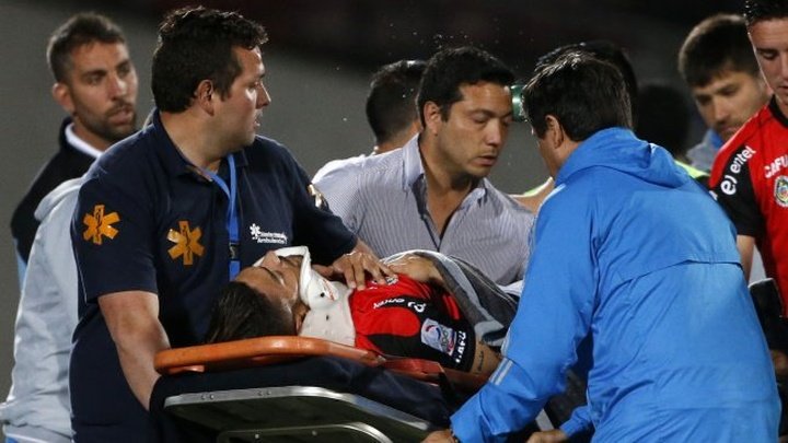 Magalhaes sufrió una laceración pulmonar en el duelo ante Universidad de Chile