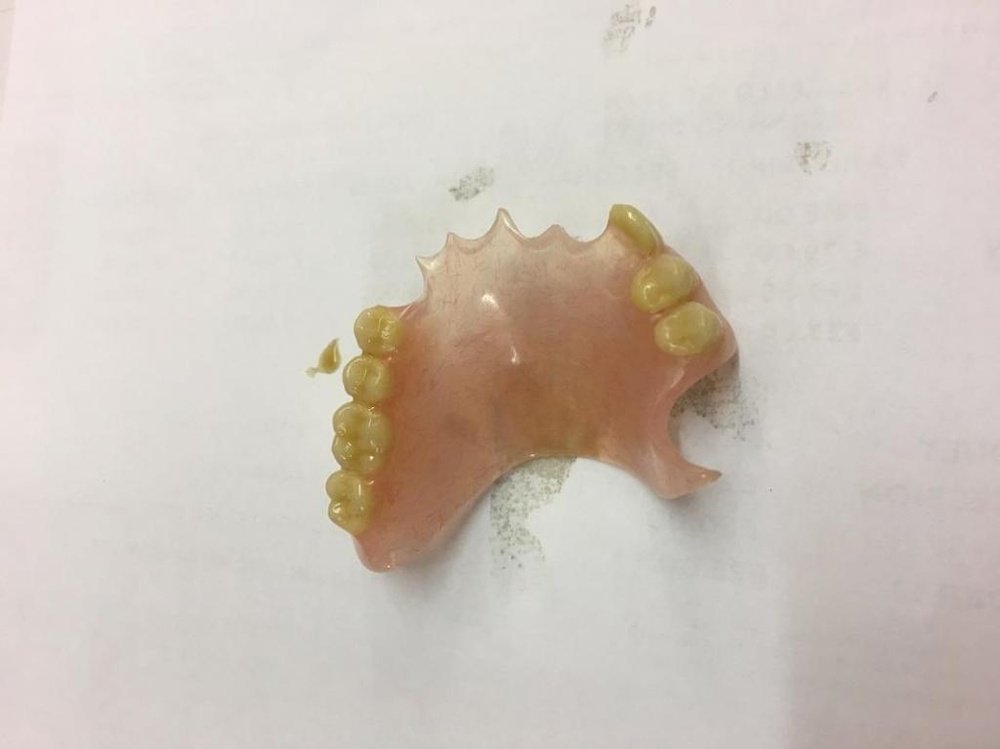 Accrington Stanley staff found a set of false teeth as Saturday's game. Twitter/ASFCofficial