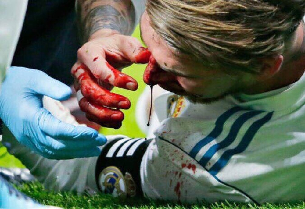 Sergio Ramos lloró de impotencia tras fracturarse el hueso propio de la nariz. Twitter/SergioRamos