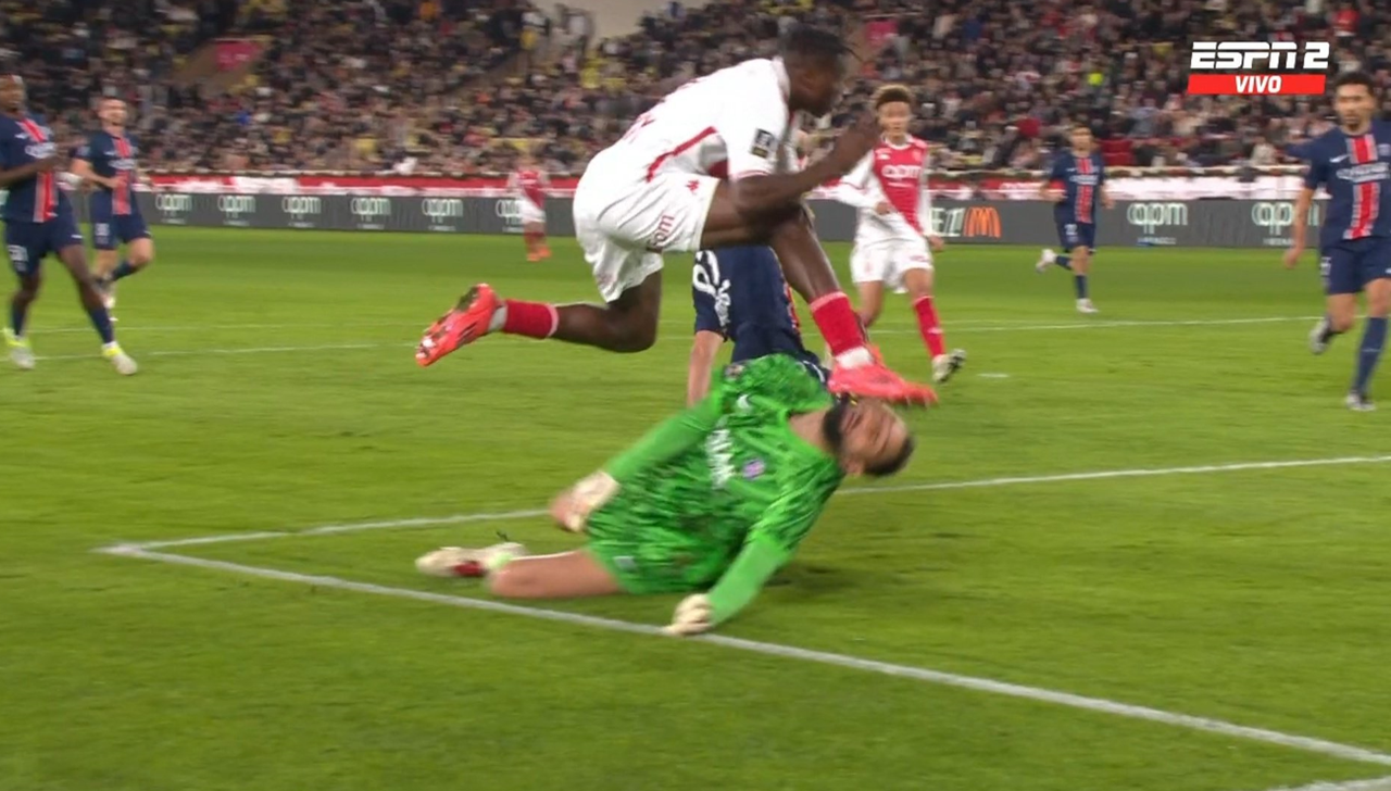 Le dure immagini del volto di Donnarumma dopo il terribile intervento di Singo