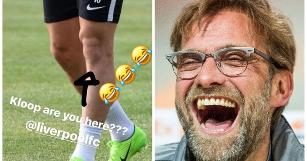 Pato claims his knee looks like Liverpool boss Jurgen Klopp. AlexandrePato
