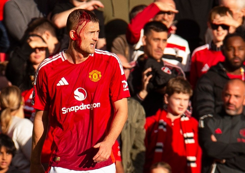 Com a cabeça sangrando, De Ligt não foi substituido em jogo United. EFE