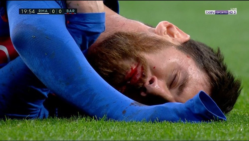 Messi a sangrar depois de lance com Marcelo. BeinSports