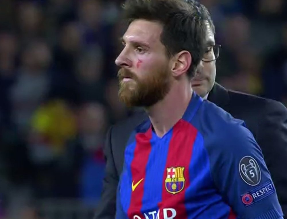 Messi sufrió una herida en el pómulo durante el Barça-Juventus. Twitter