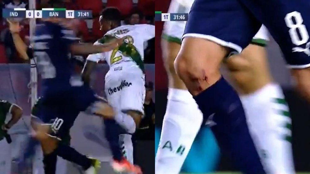 Así quedó la rodilla de Pablo Pérez tras clavarle los tacos. Capturas/TNTSportsLA