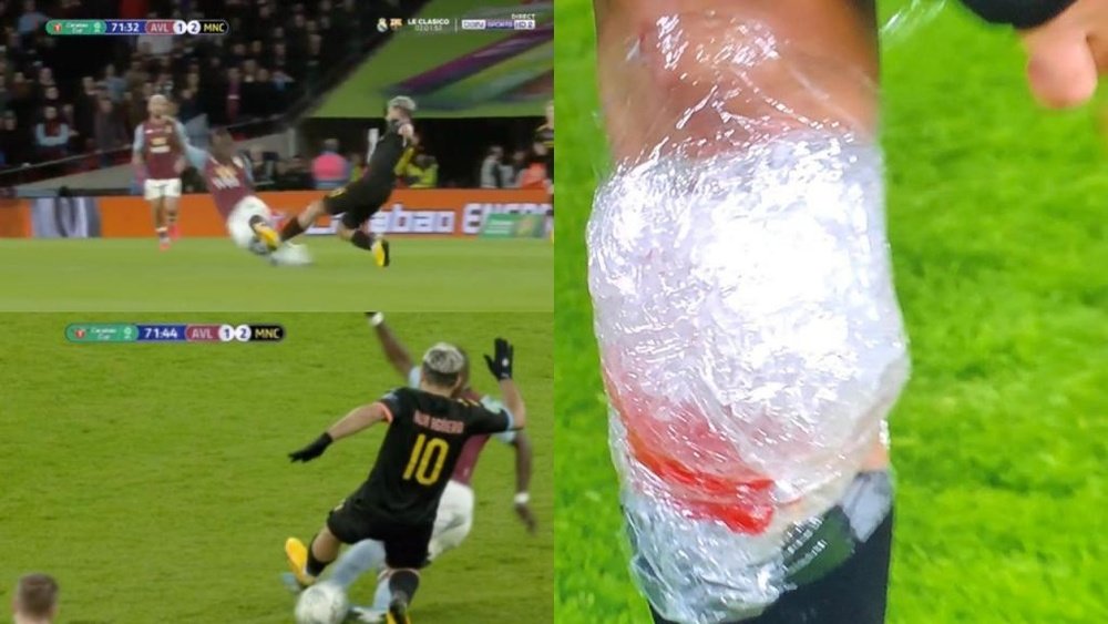 Agüero s'est-il blessé de lors de la finale de l'EFL Cup ? Capture/Beinsports