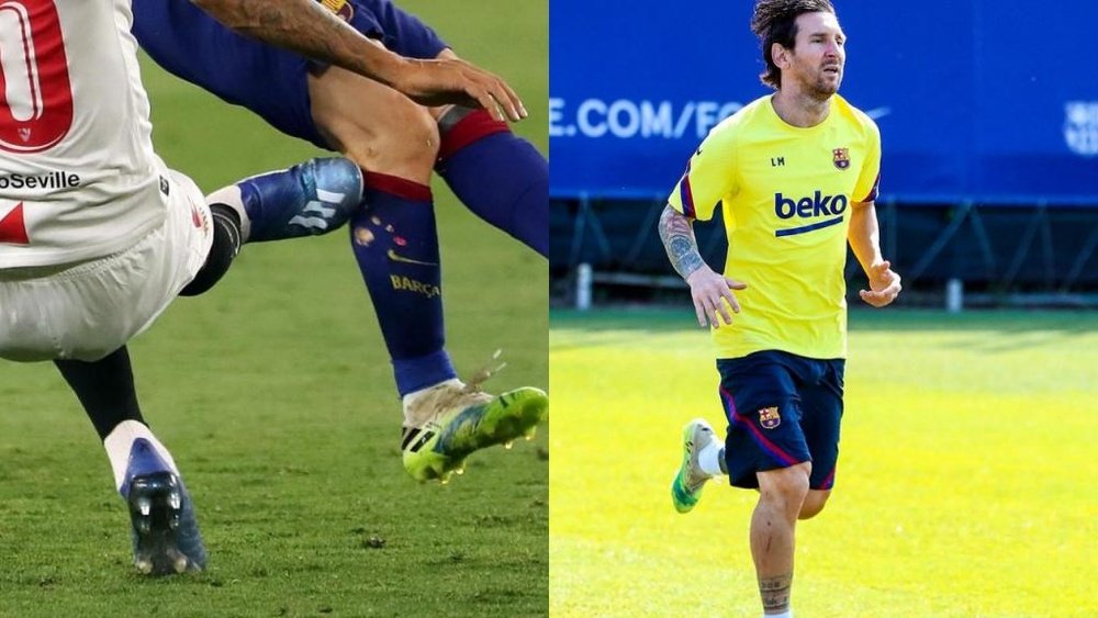 Messi has a mark on his shin. Twitter/FCBarcelona.es