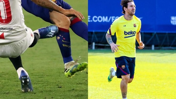 No wonder Messi was angry: that's how Diego Carlos left his leg