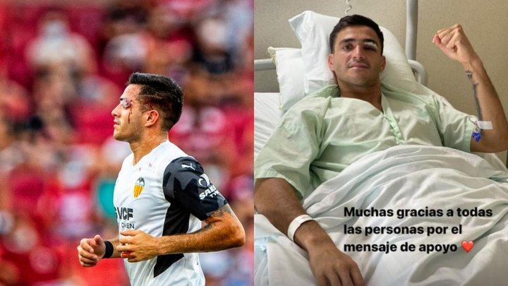 Maxi Gómez passou a noite no hospital por problemas de visão