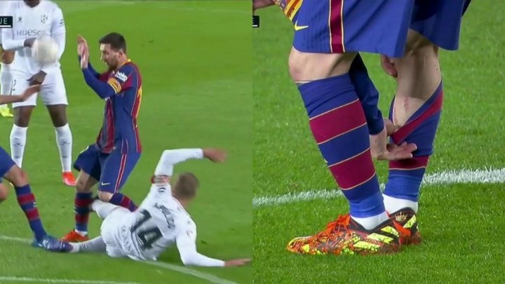 Escalofriante: Pulido le clavó los tacos a Messi en la pantorrilla