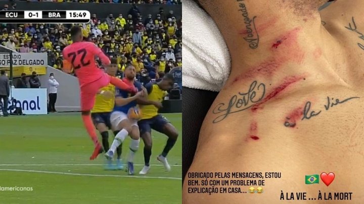 Las heridas de guerra de Cunha tras el patadón de Domínguez: 